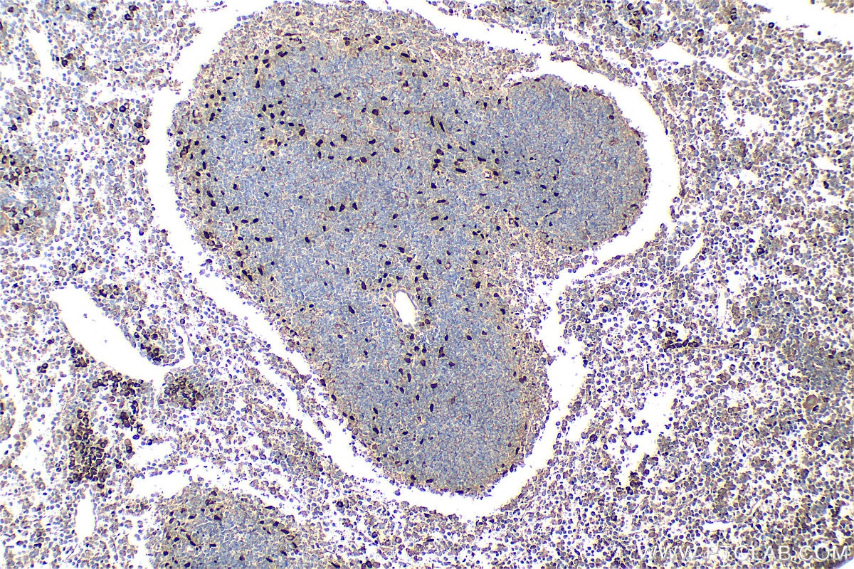 Immunohistochemistry (IHC) staining of mouse spleen tissue using IL-33 Polyclonal antibody (28035-1-AP)