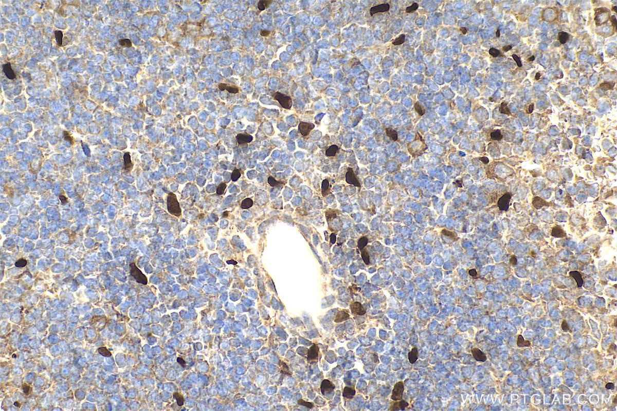 Immunohistochemistry (IHC) staining of mouse spleen tissue using IL-33 Polyclonal antibody (28035-1-AP)