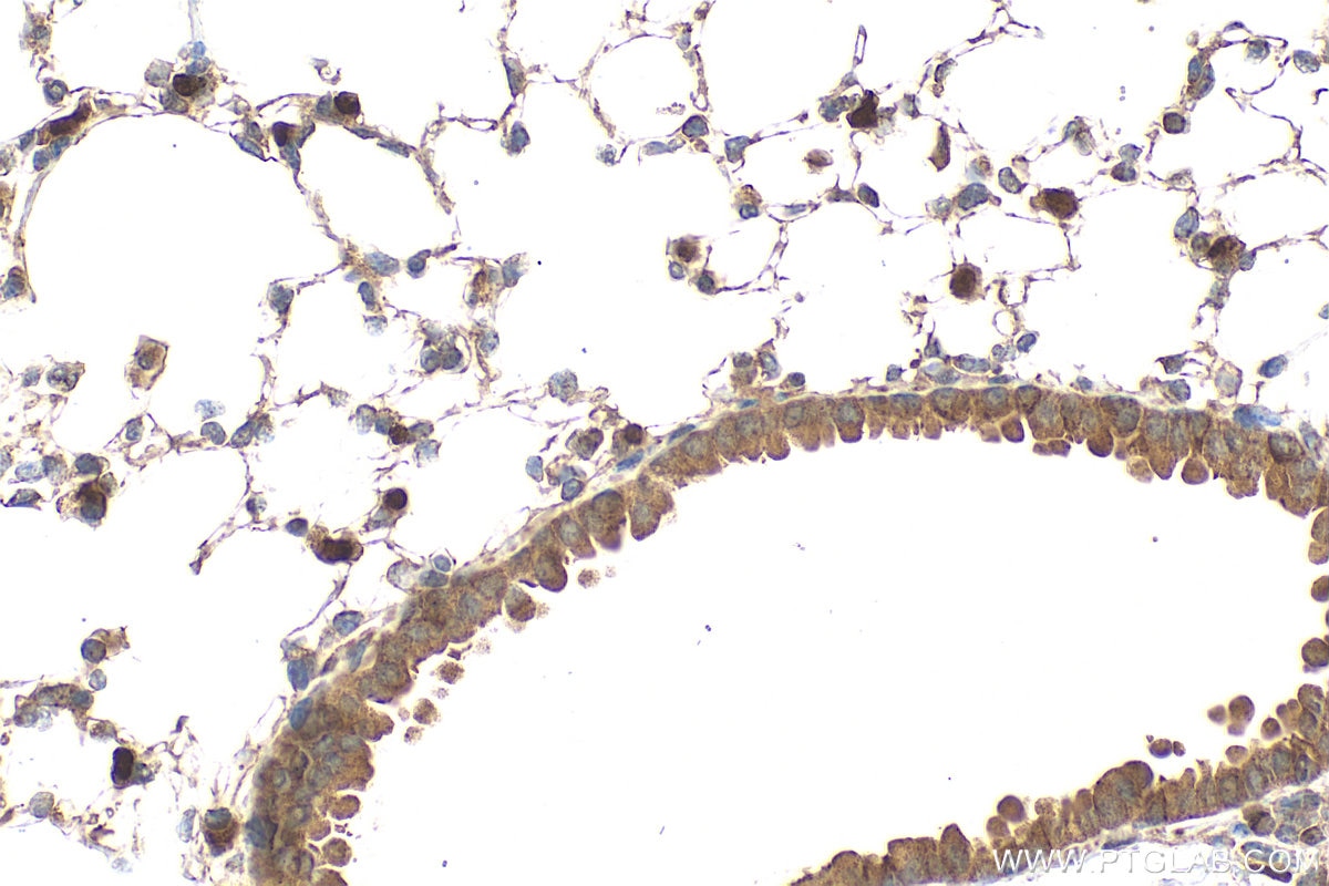 Immunohistochemistry (IHC) staining of mouse lung tissue using IL-33 Polyclonal antibody (28035-1-AP)
