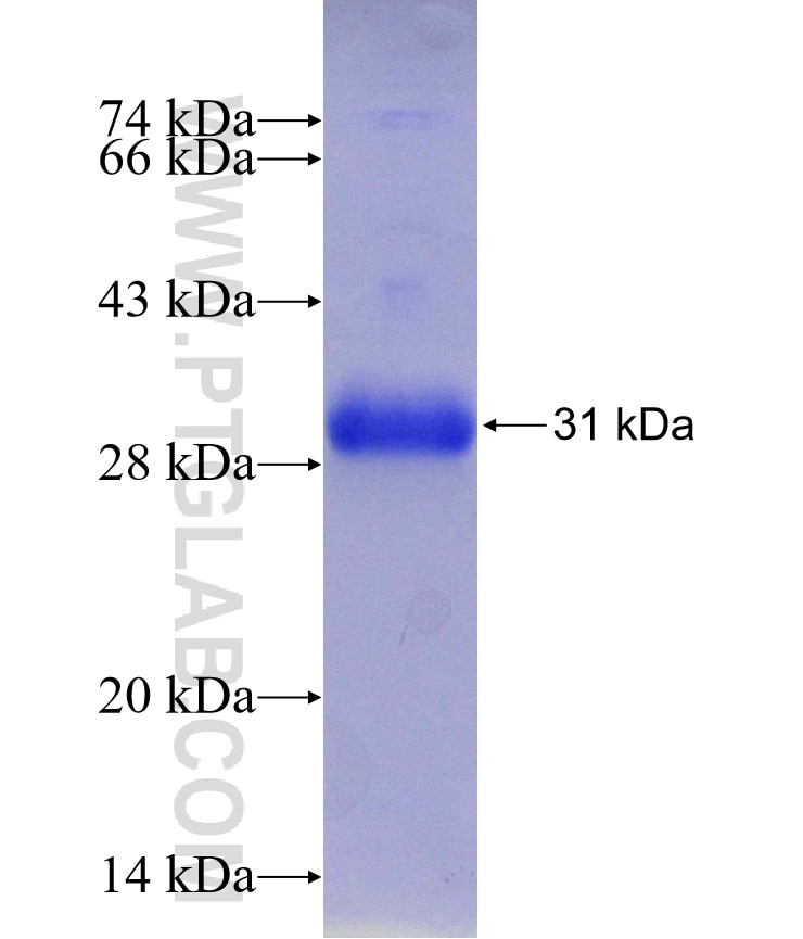 insulin1 fusion protein Ag29989 SDS-PAGE