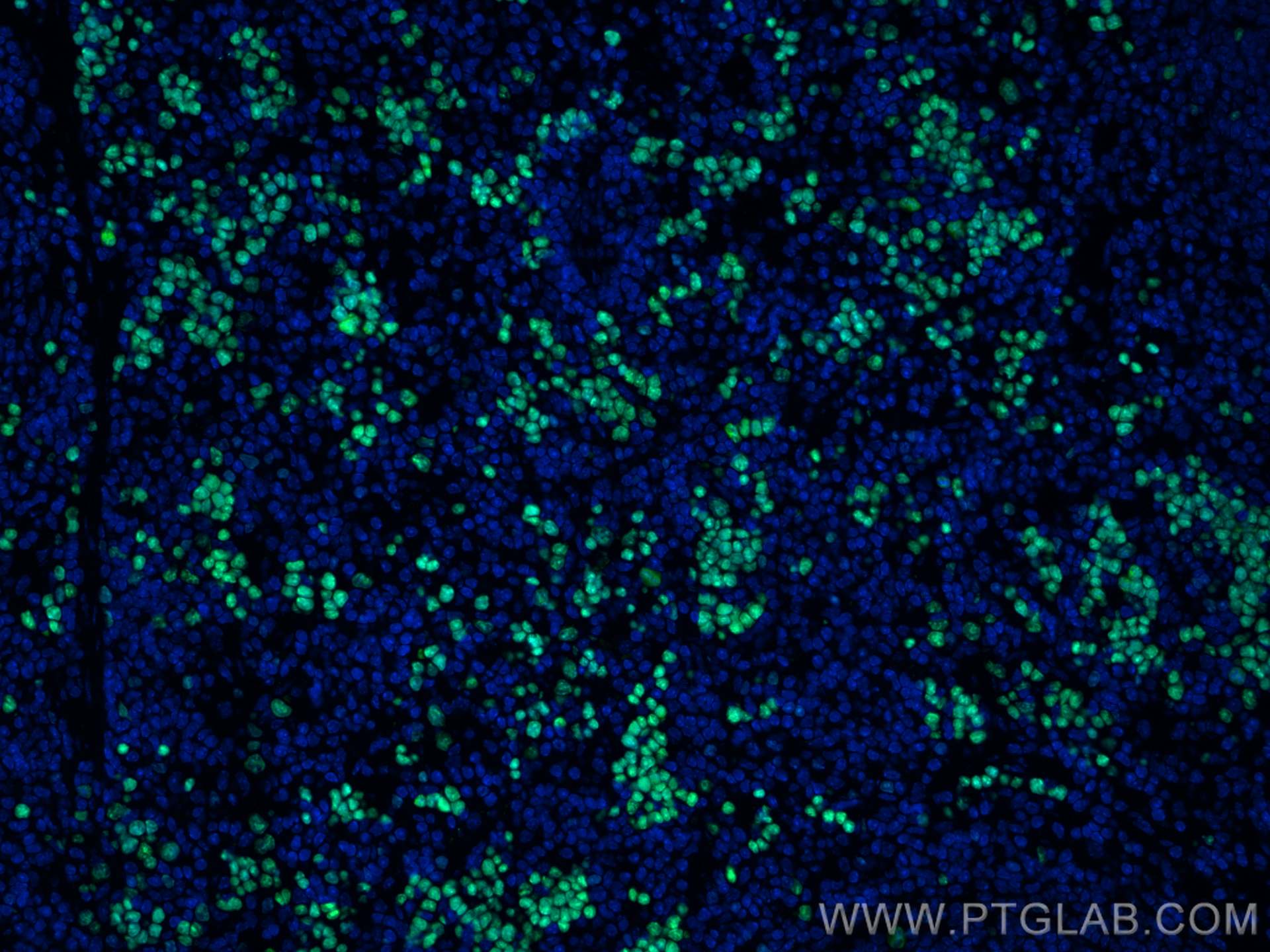 Immunofluorescence (IF) / fluorescent staining of mouse spleen tissue using ki67 Polyclonal antibody (28074-1-AP)