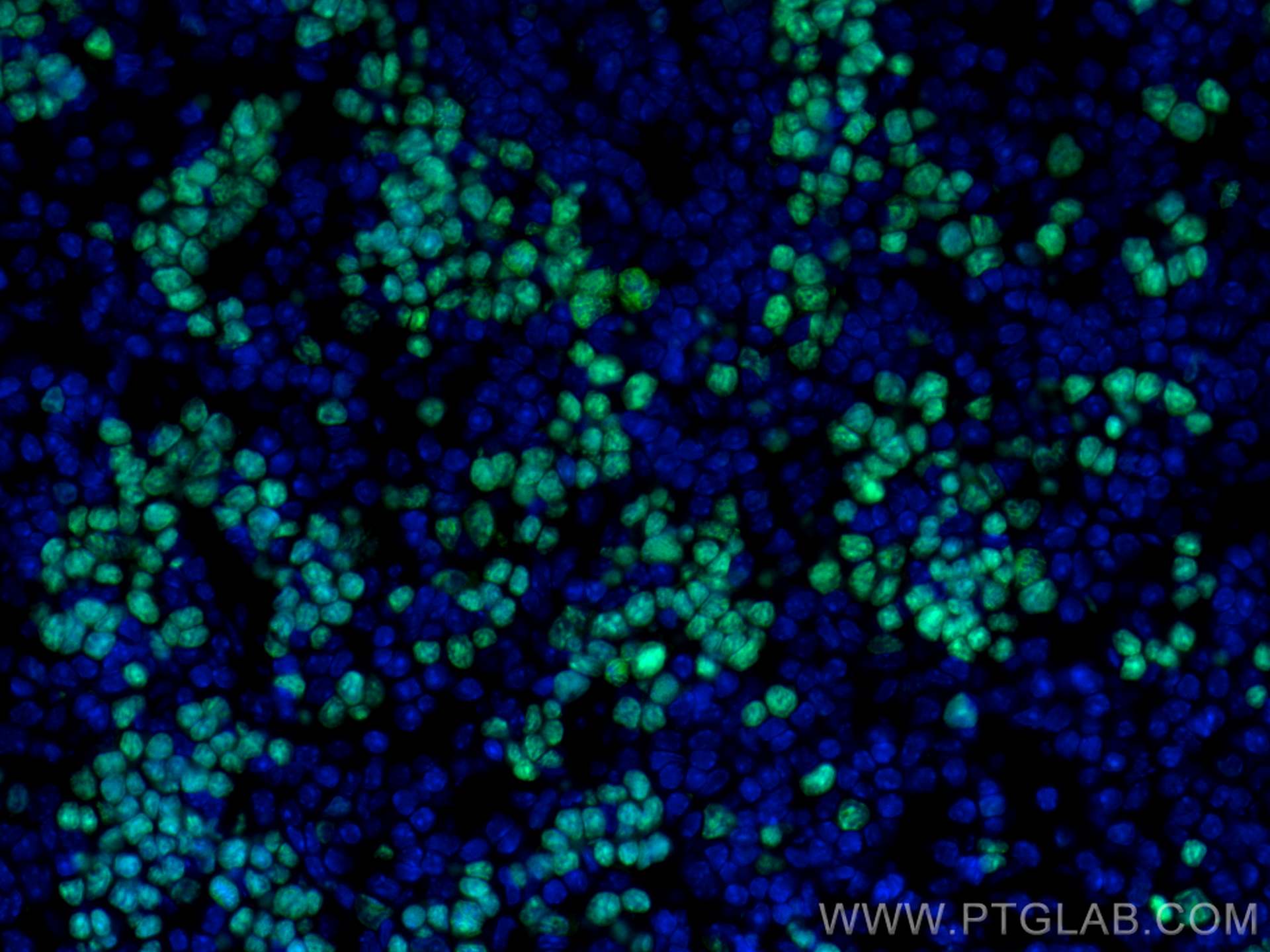 Immunofluorescence (IF) / fluorescent staining of mouse spleen tissue using ki67 Polyclonal antibody (28074-1-AP)