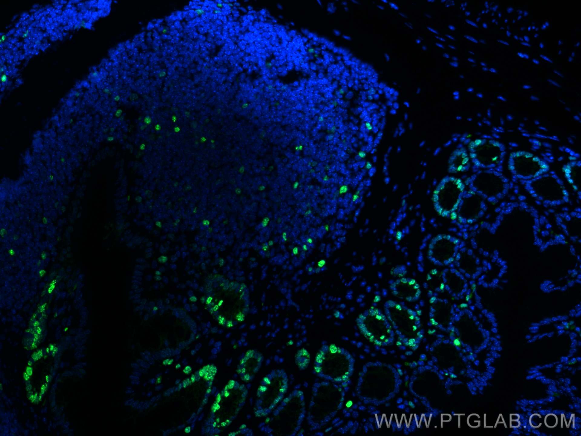 Immunofluorescence (IF) / fluorescent staining of mouse colon tissue using ki67 Polyclonal antibody (28074-1-AP)