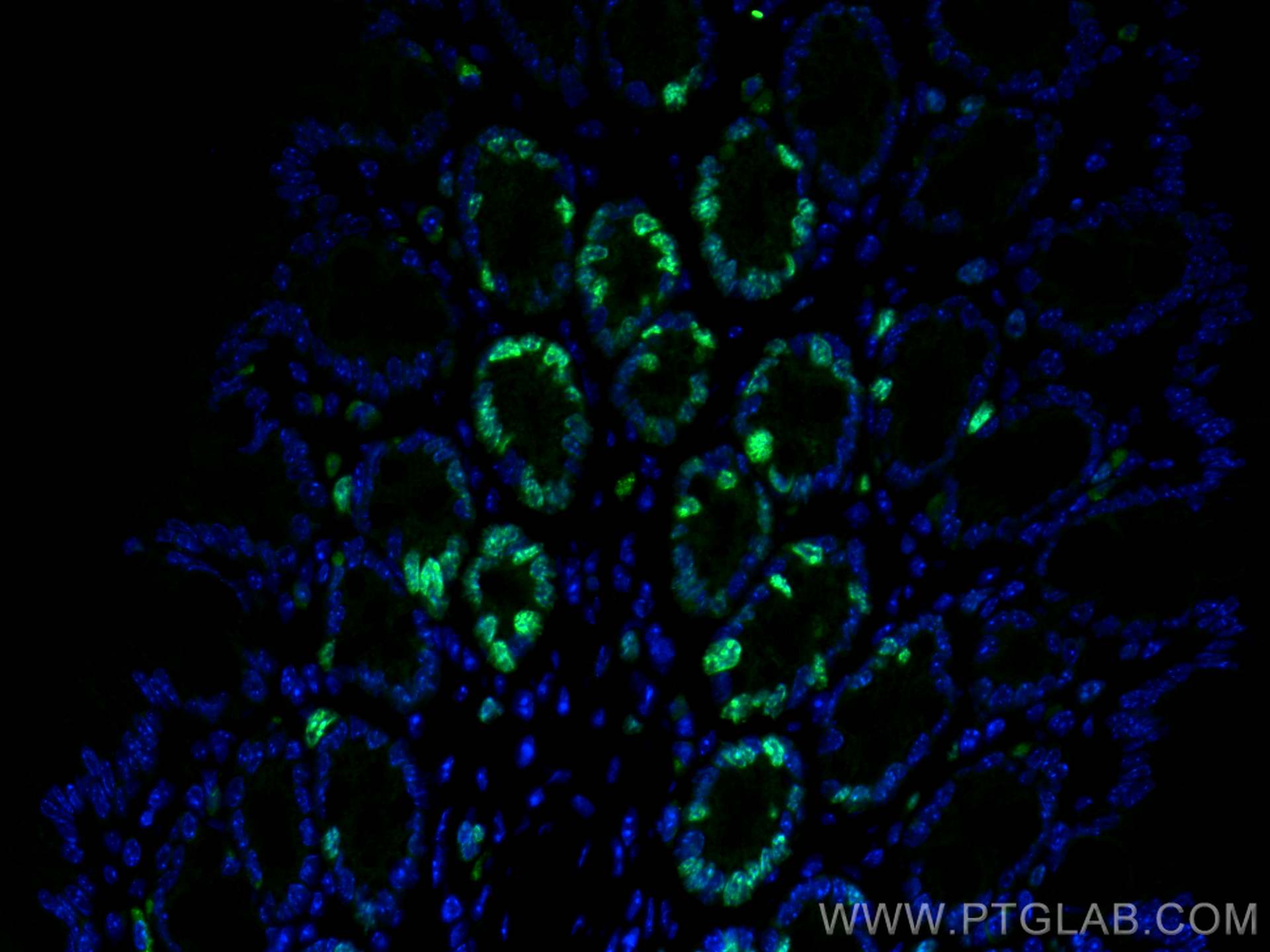 Immunofluorescence (IF) / fluorescent staining of mouse colon tissue using ki67 Polyclonal antibody (28074-1-AP)