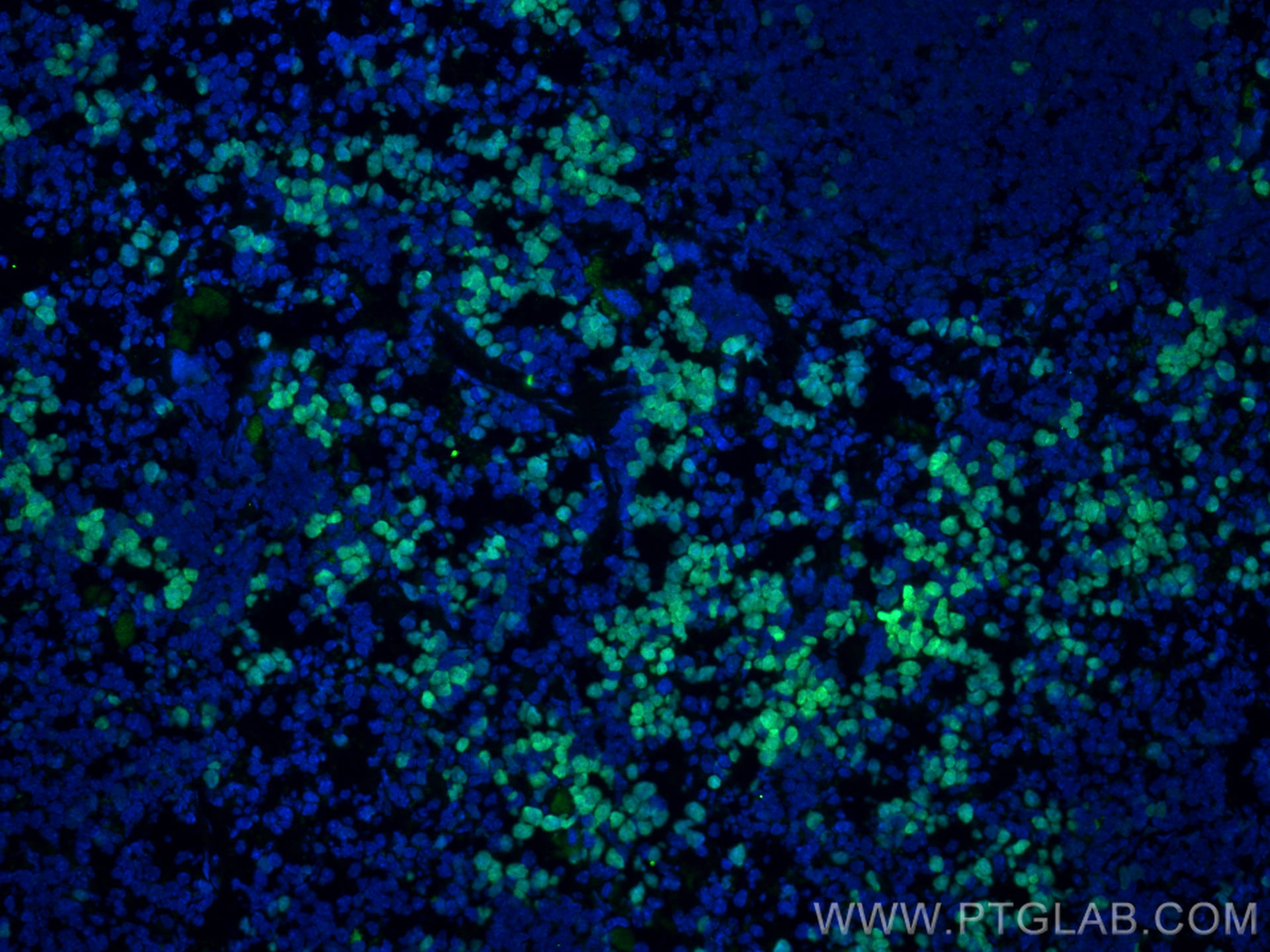 Immunofluorescence (IF) / fluorescent staining of mouse spleen tissue using ki67 Polyclonal antibody (28074-1-AP)