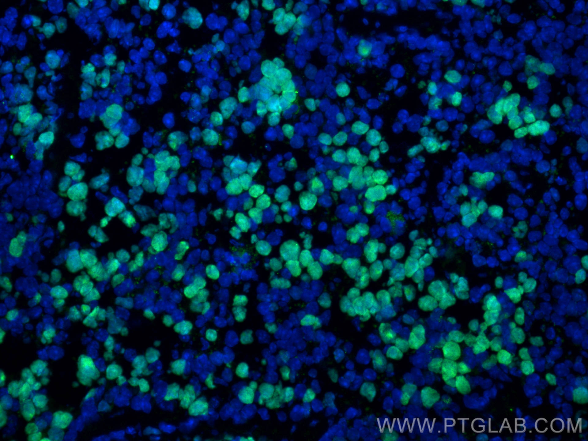 Immunofluorescence (IF) / fluorescent staining of mouse spleen tissue using ki67 Polyclonal antibody (28074-1-AP)