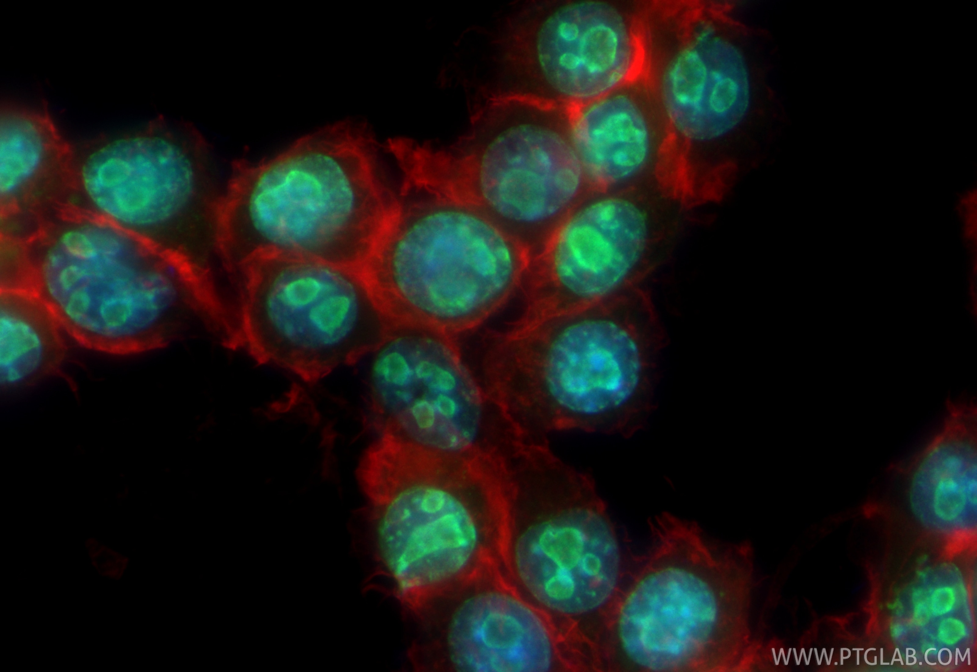 IF Staining of BV-2 using 28074-1-AP Immunofluorescence (IF) / fluorescent staining of BV-2 cells using Ki-67 Polyclonal antibody (28074-1-AP)