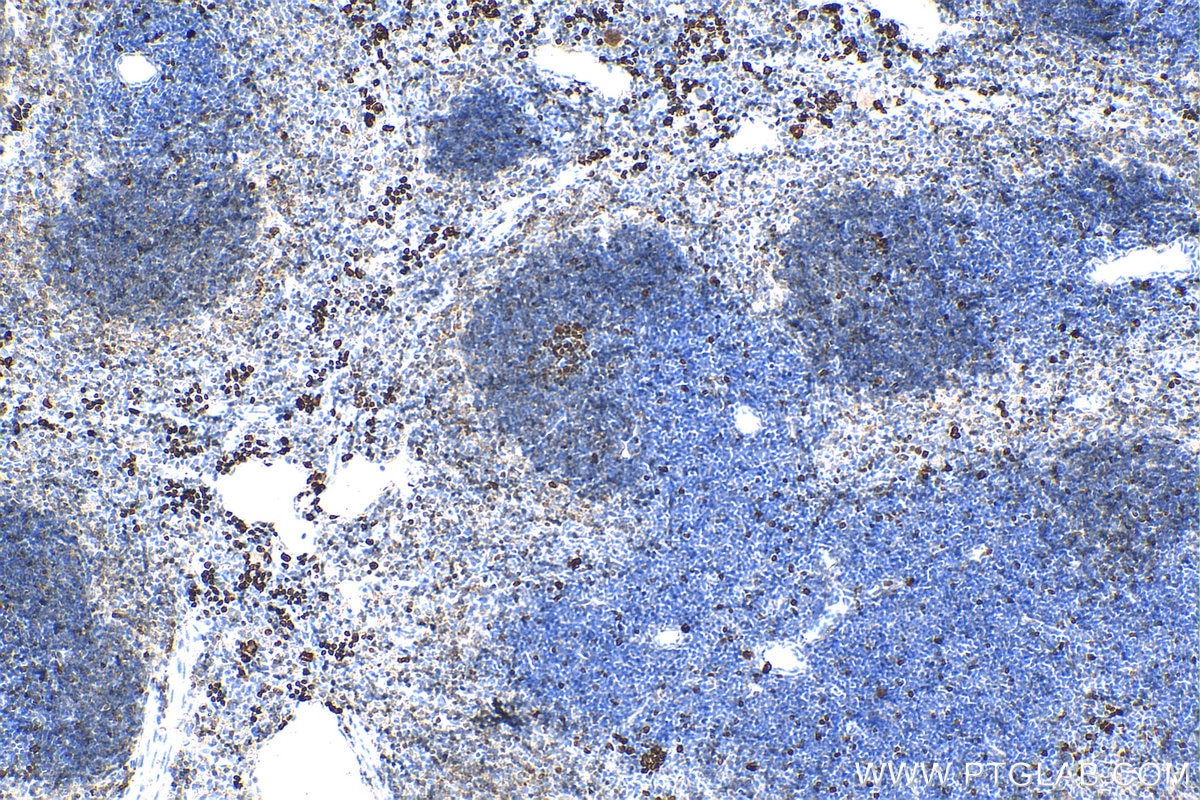 Immunohistochemistry (IHC) staining of mouse spleen tissue using ki67 Polyclonal antibody (28074-1-AP)