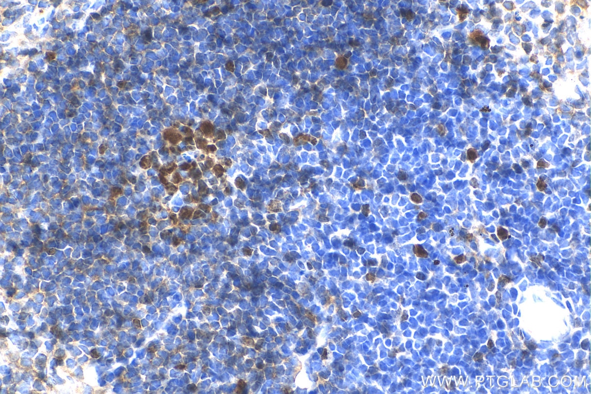 Immunohistochemistry (IHC) staining of mouse spleen tissue using ki67 Polyclonal antibody (28074-1-AP)