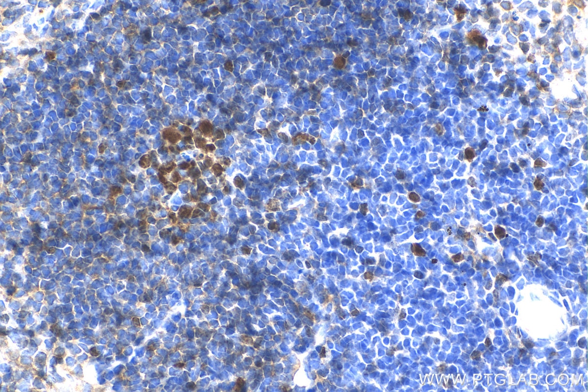 IHC staining of mouse spleen using 28074-1-AP