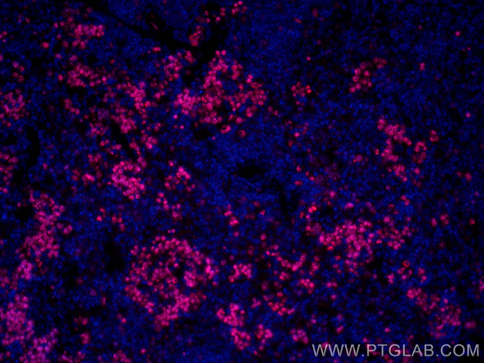 Immunofluorescence (IF) / fluorescent staining of mouse spleen tissue using CoraLite® Plus 594-conjugated ki67 Polyclonal anti (CL594-28074)