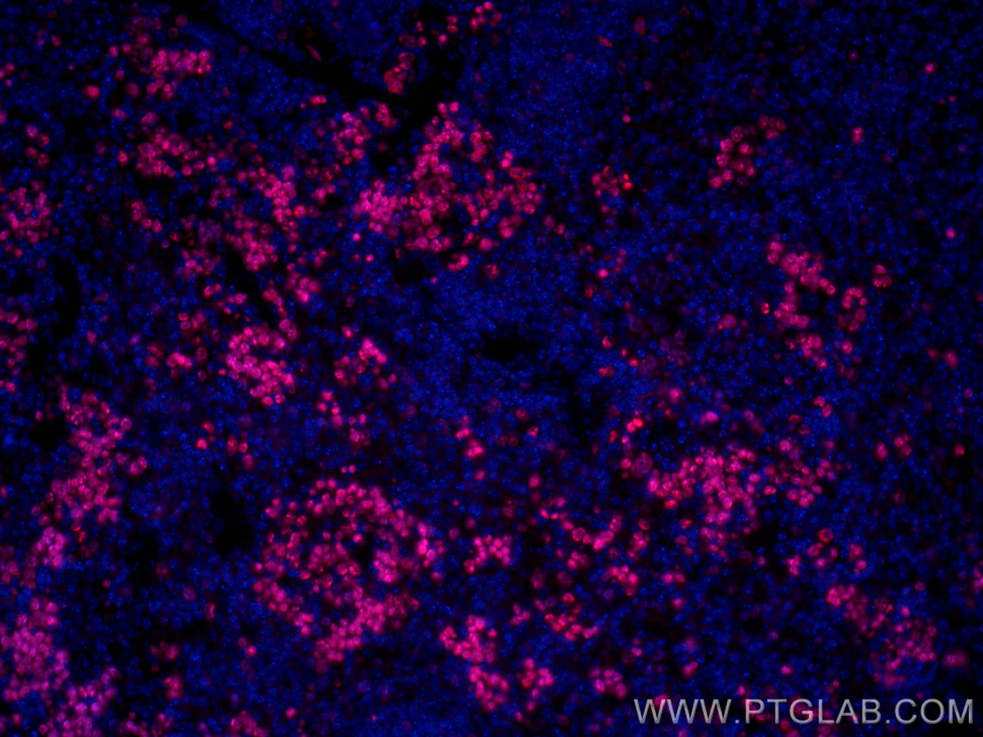 IF Staining of mouse spleen using CL594-28074