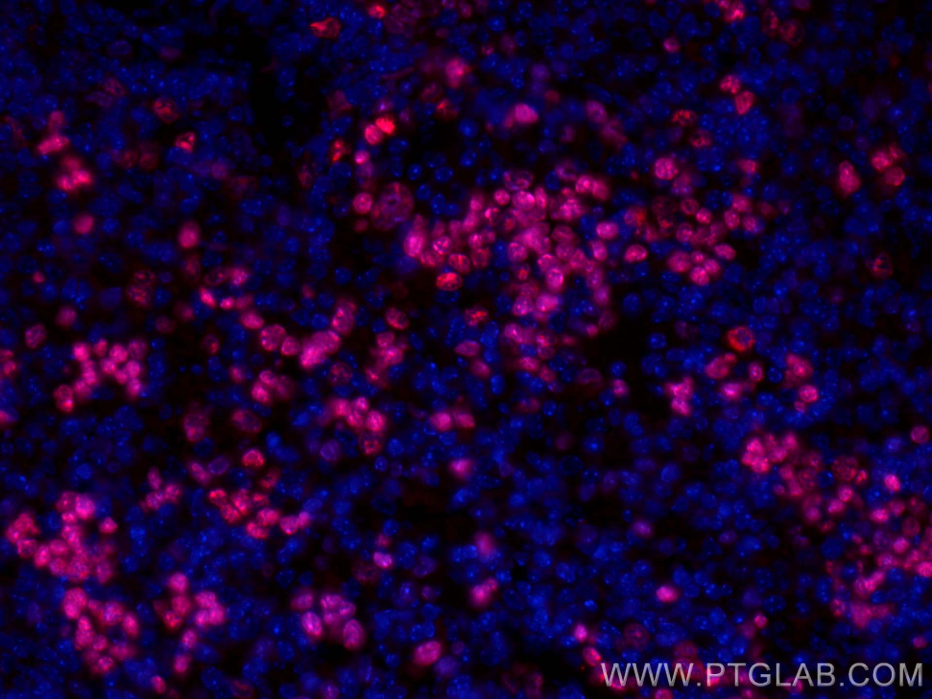 Immunofluorescence (IF) / fluorescent staining of mouse spleen tissue using CoraLite® Plus 594-conjugated ki67 Polyclonal anti (CL594-28074)