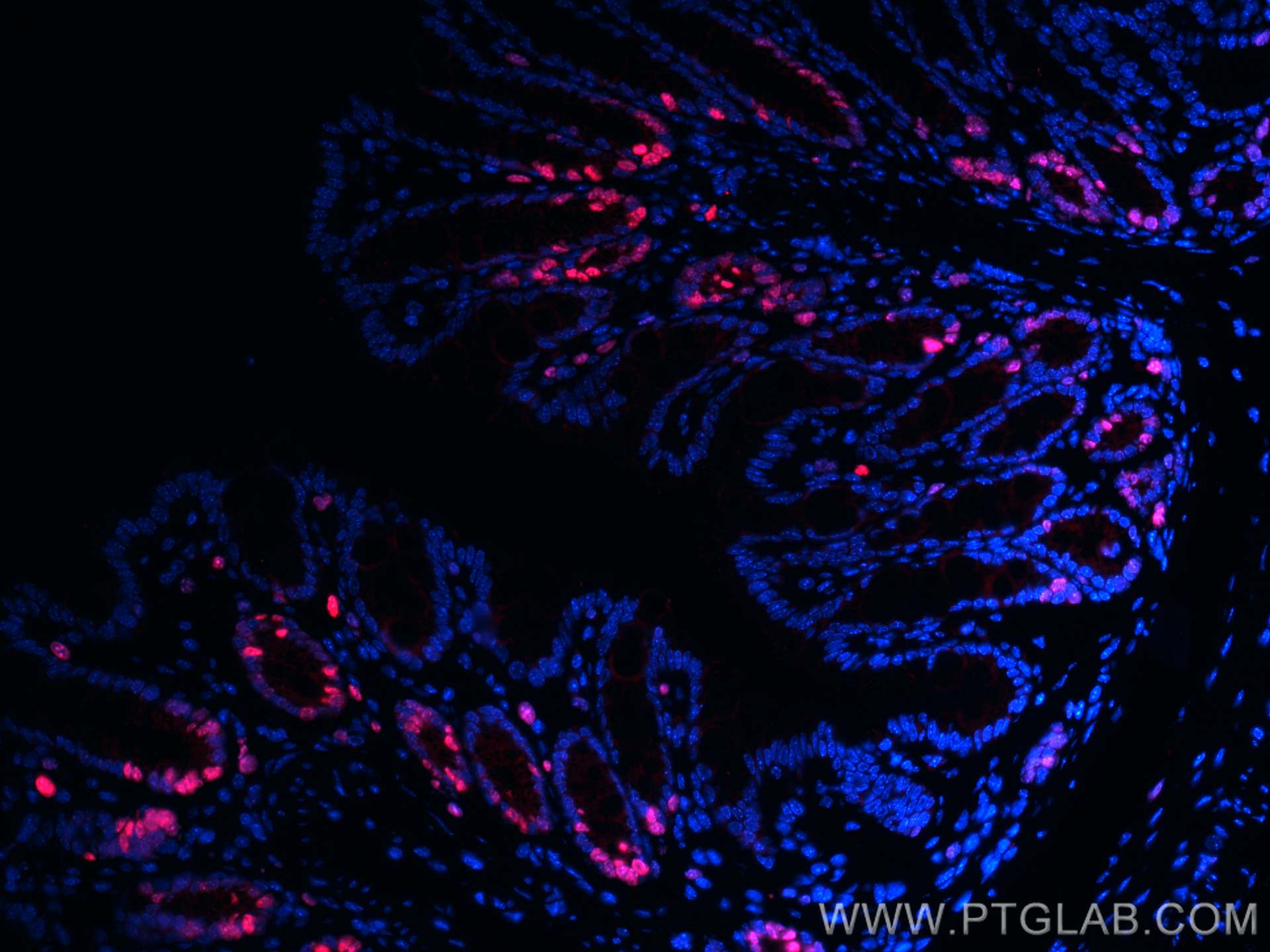 Immunofluorescence (IF) / fluorescent staining of mouse colon tissue using CoraLite® Plus 594-conjugated ki67 Polyclonal anti (CL594-28074)