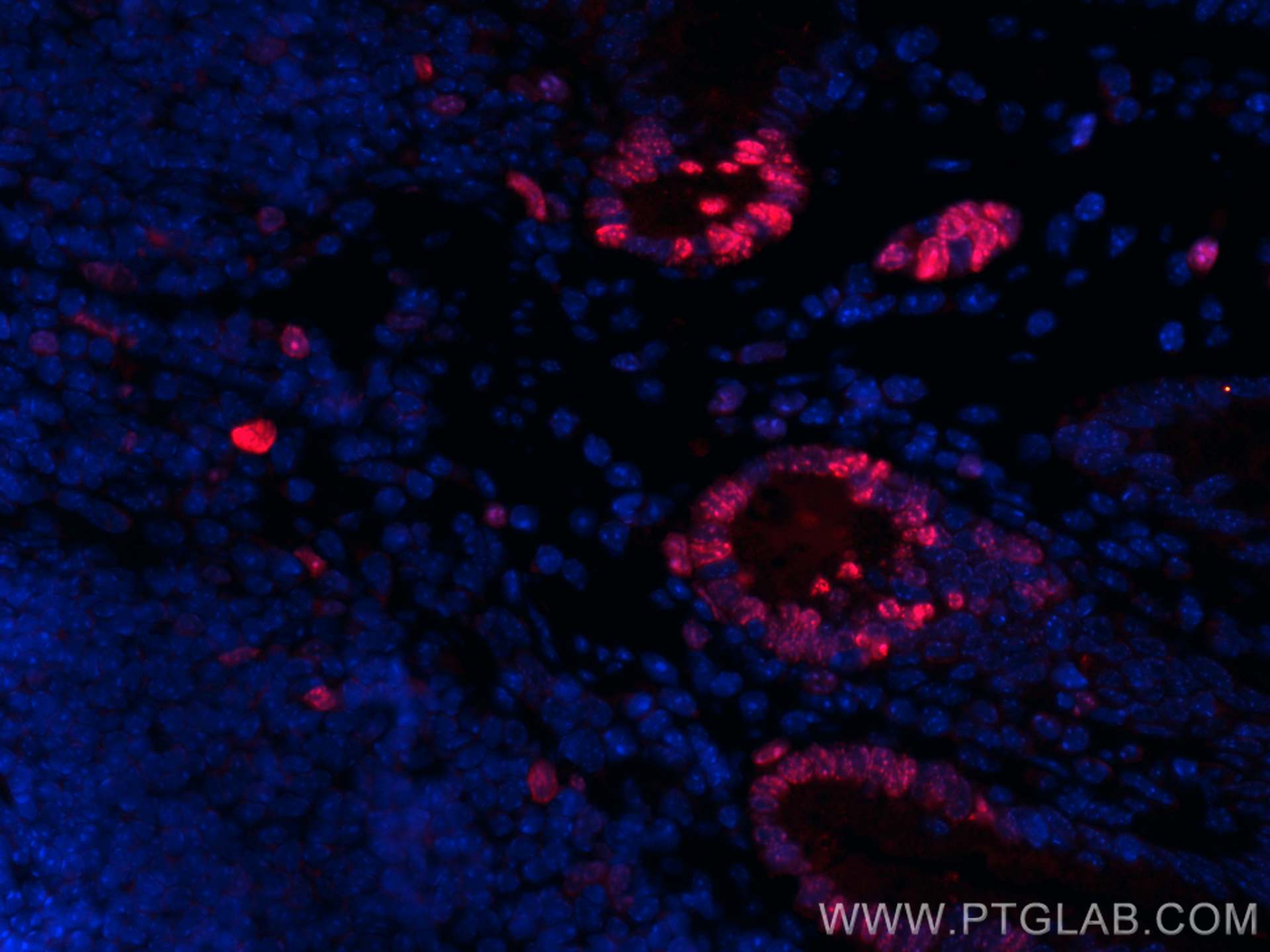 Immunofluorescence (IF) / fluorescent staining of mouse colon tissue using CoraLite® Plus 594-conjugated ki67 Polyclonal anti (CL594-28074)