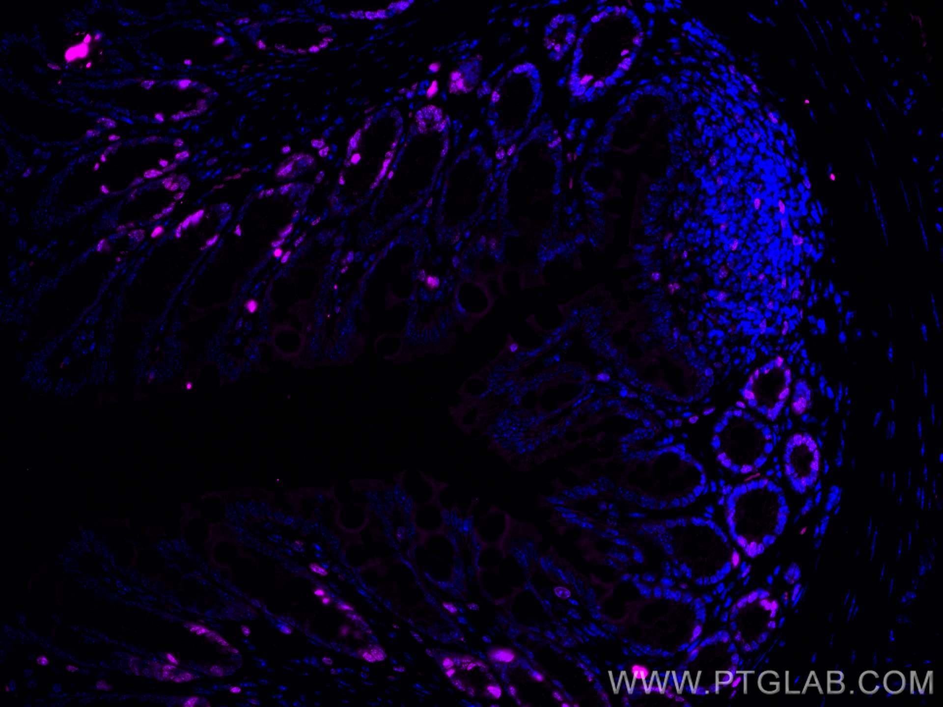 Immunofluorescence (IF) / fluorescent staining of mouse colon tissue using CoraLite® Plus 647-conjugated ki67 Polyclonal anti (CL647-28074)