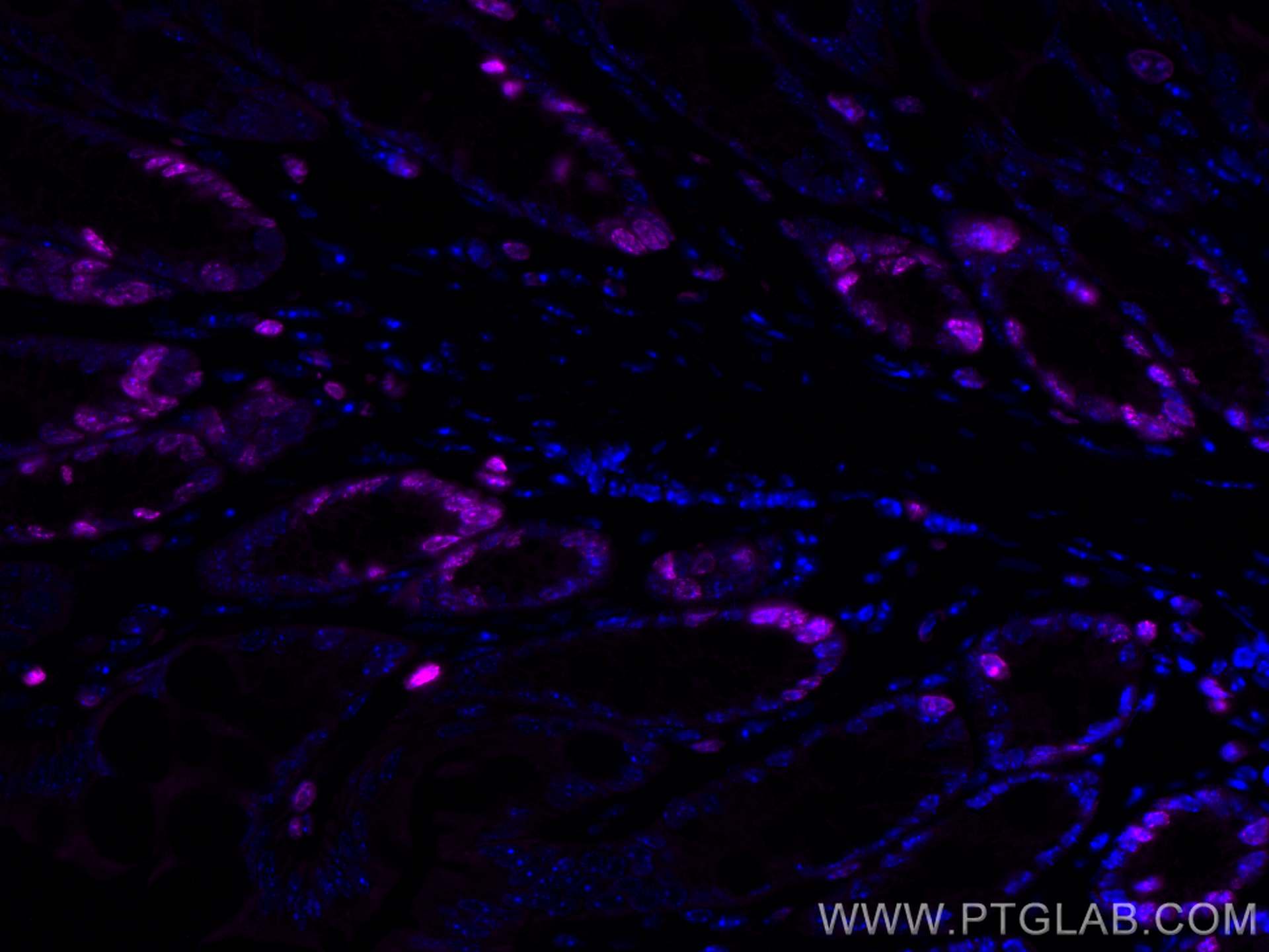 Immunofluorescence (IF) / fluorescent staining of mouse colon tissue using CoraLite® Plus 647-conjugated ki67 Polyclonal anti (CL647-28074)