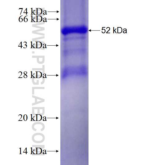 ki67 fusion protein Ag27894 SDS-PAGE