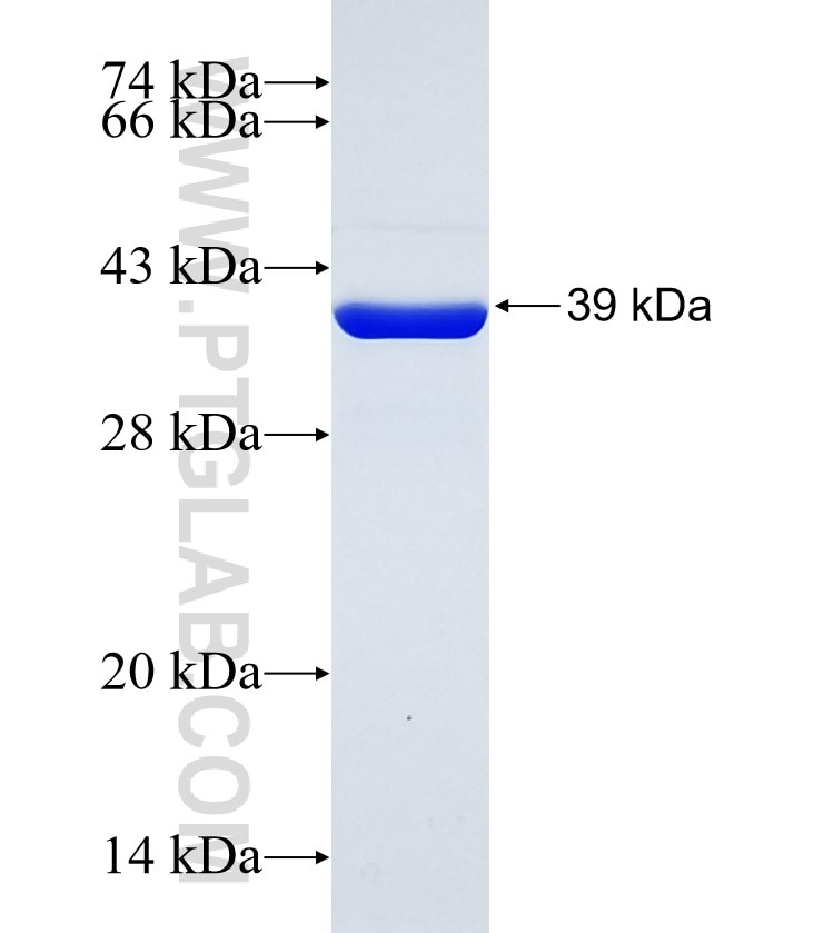 lama3 fusion protein Ag30157 SDS-PAGE