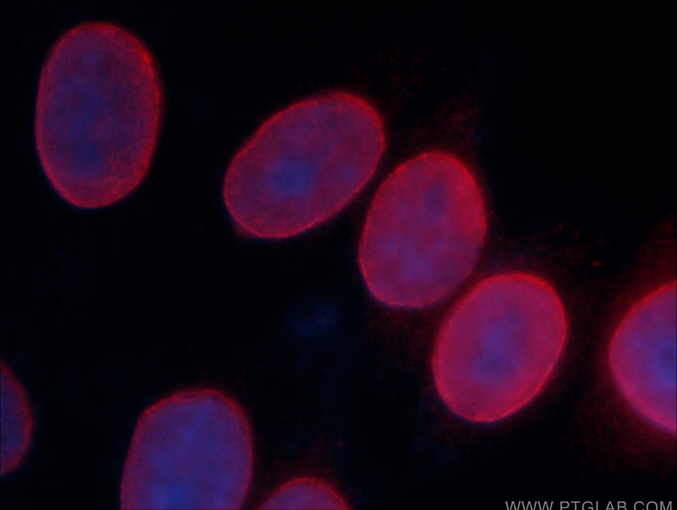 Immunofluorescence (IF) / fluorescent staining of HeLa cells using Lamin A/C Polyclonal antibody (10298-1-AP)