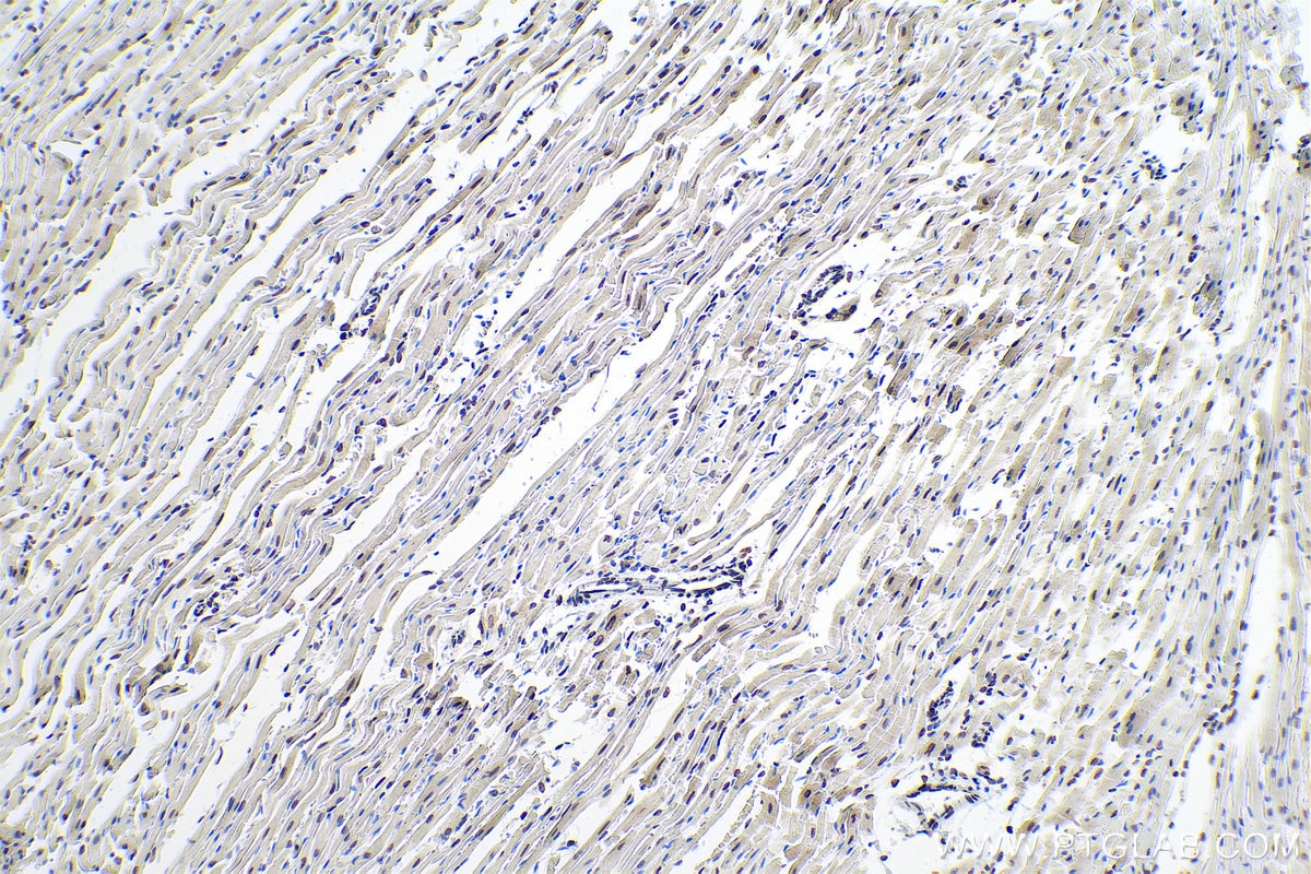 Immunohistochemistry (IHC) staining of mouse heart tissue using Lamin A/C Polyclonal antibody (10298-1-AP)