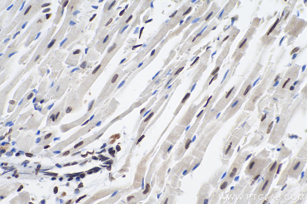 Immunohistochemistry (IHC) staining of mouse heart tissue using Lamin A/C Polyclonal antibody (10298-1-AP)