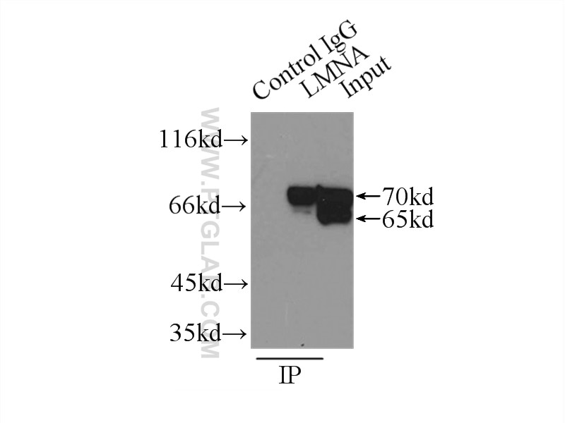 Immunoprecipitation (IP) experiment of A375 cells using Lamin A/C Polyclonal antibody (10298-1-AP)
