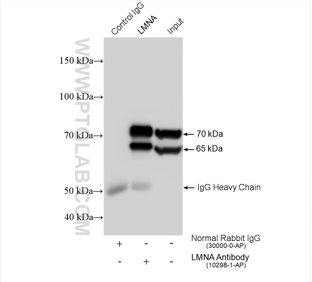 Immunoprecipitation (IP) experiment of HeLa cells using Lamin A/C Polyclonal antibody (10298-1-AP)