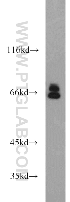 Western Blot (WB) analysis of mouse ovary tissue using Lamin A/C Polyclonal antibody (10298-1-AP)