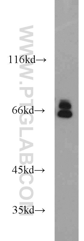 WB analysis of mouse ovary using 10298-1-AP