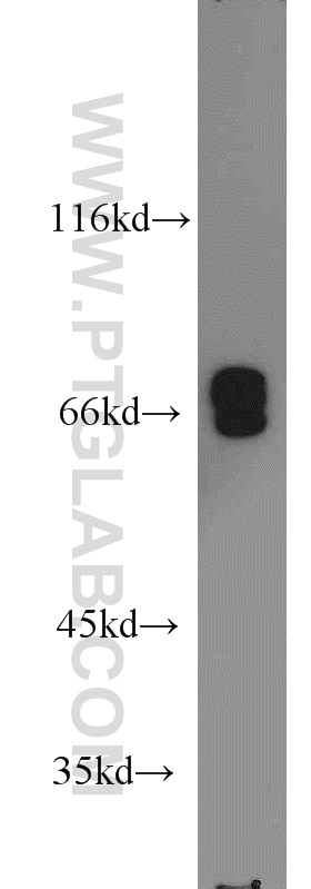 Western Blot (WB) analysis of SKOV-3 cells using Lamin A/C Polyclonal antibody (10298-1-AP)