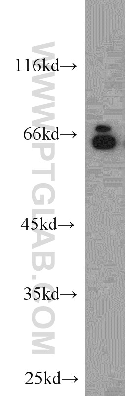 Western Blot (WB) analysis of HEK-293 cells using Lamin A/C Polyclonal antibody (10298-1-AP)