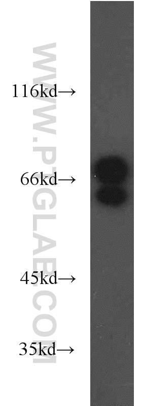 Western Blot (WB) analysis of A375 cells using Lamin A/C Polyclonal antibody (10298-1-AP)