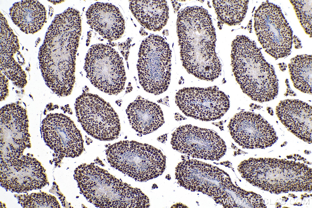 Immunohistochemistry (IHC) staining of mouse testis tissue using m5C Monoclonal antibody (68301-1-Ig)