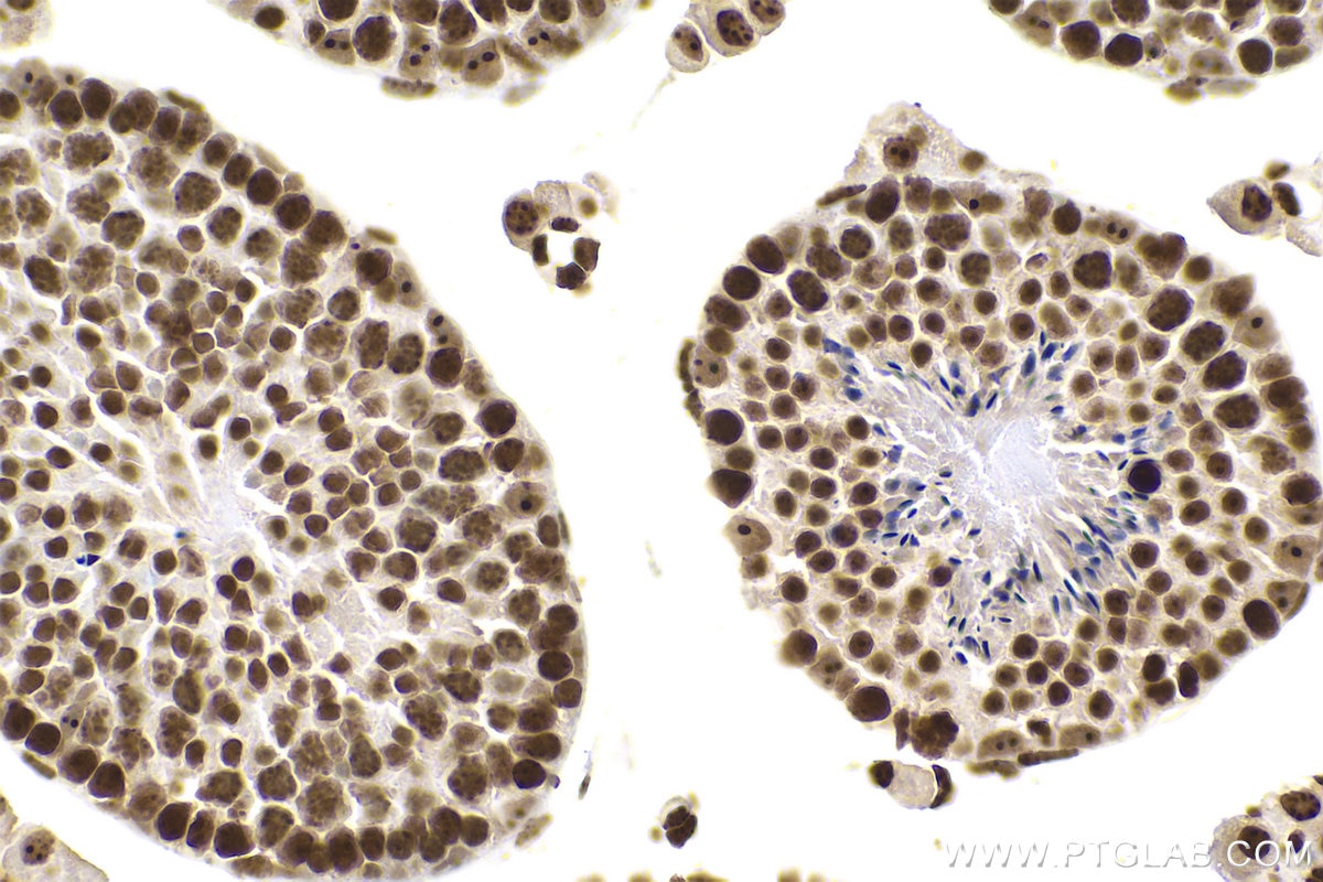 Immunohistochemistry (IHC) staining of mouse testis tissue using m5C Monoclonal antibody (68301-1-Ig)