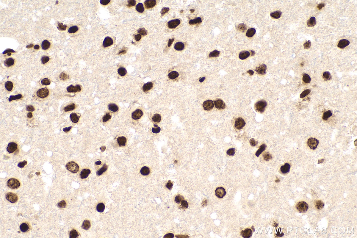 Immunohistochemistry (IHC) staining of rat brain tissue using m5C Monoclonal antibody (68301-1-Ig)