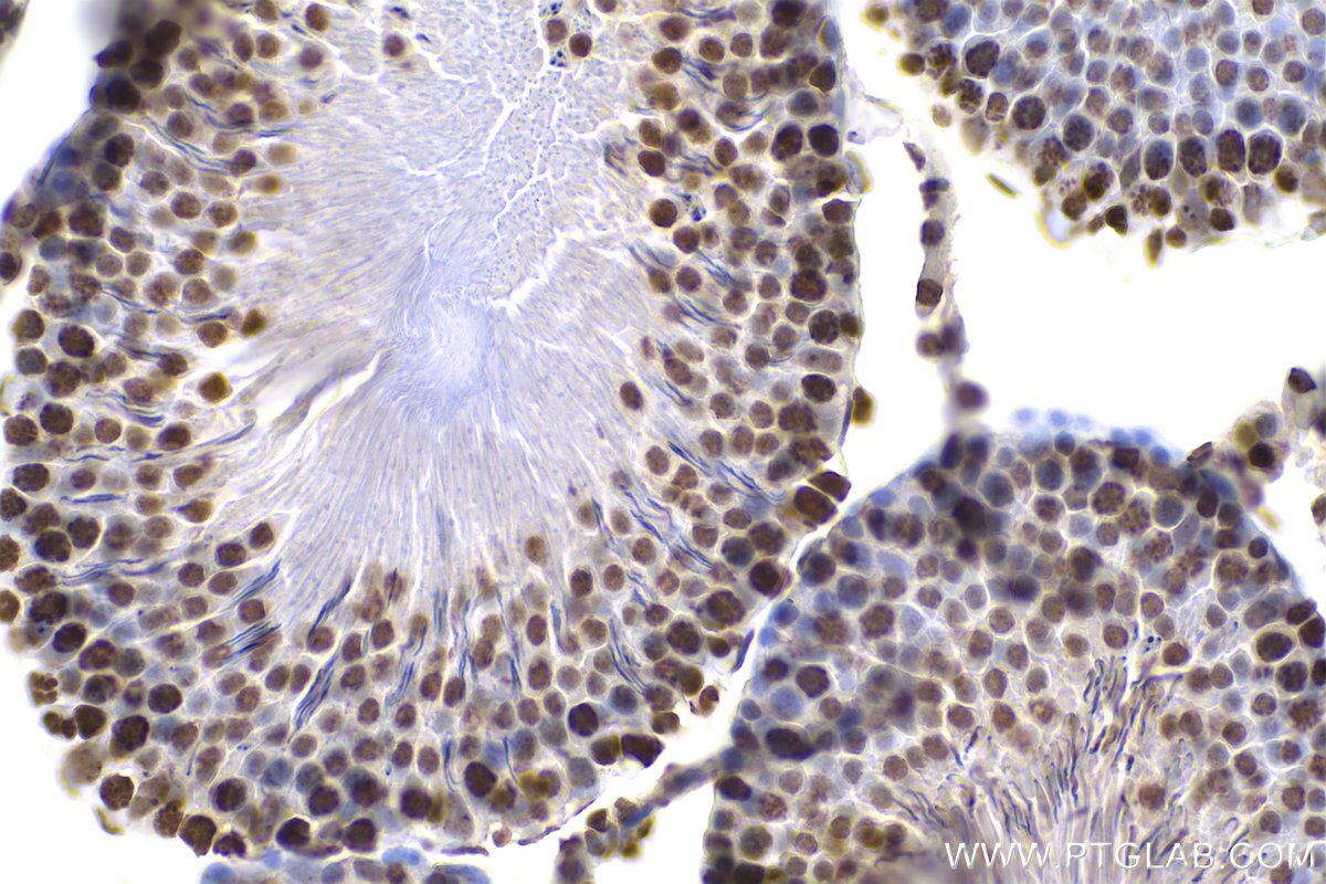 Immunohistochemistry (IHC) staining of rat testis tissue using m5C Monoclonal antibody (68301-1-Ig)