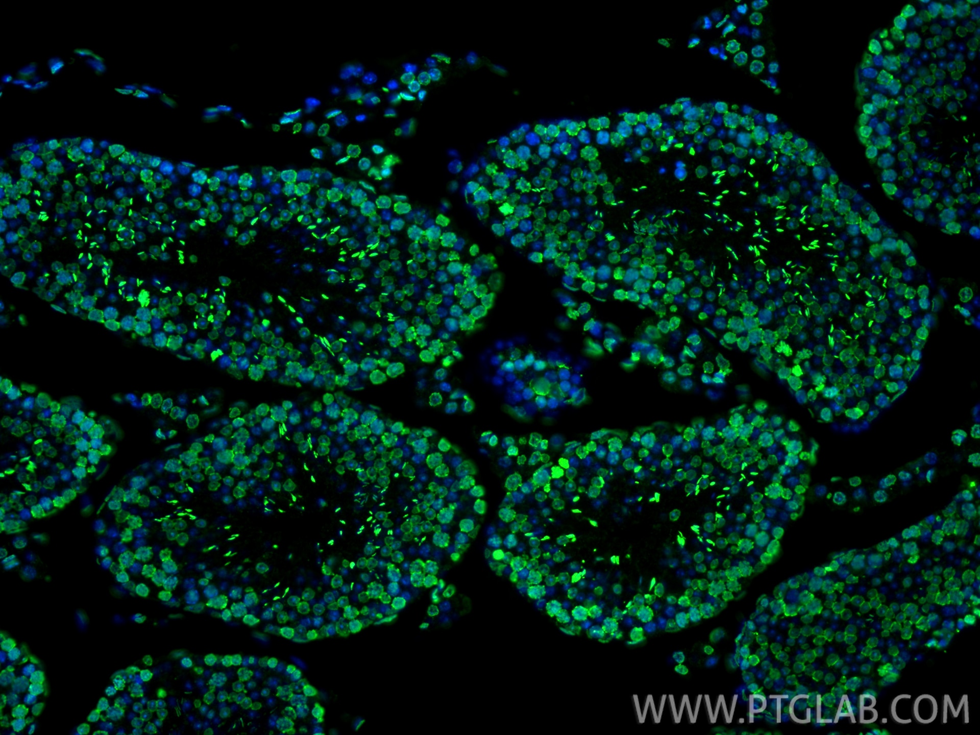 Immunofluorescence (IF) / fluorescent staining of mouse testis tissue using m6A Monoclonal antibody (68055-1-Ig)
