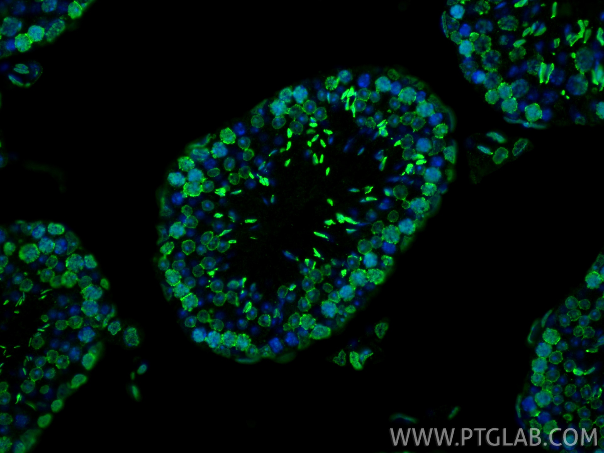 Immunofluorescence (IF) / fluorescent staining of mouse testis tissue using m6A Monoclonal antibody (68055-1-Ig)