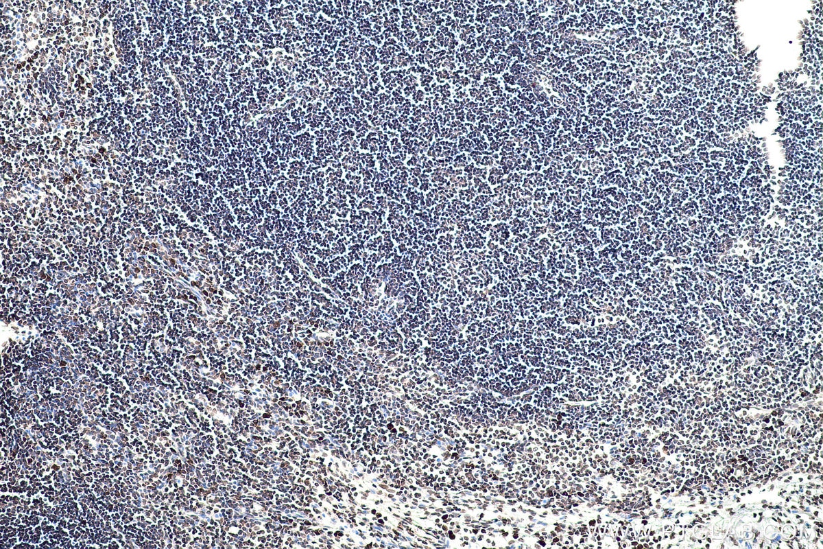 IHC staining of rat lymph node using 68055-1-Ig