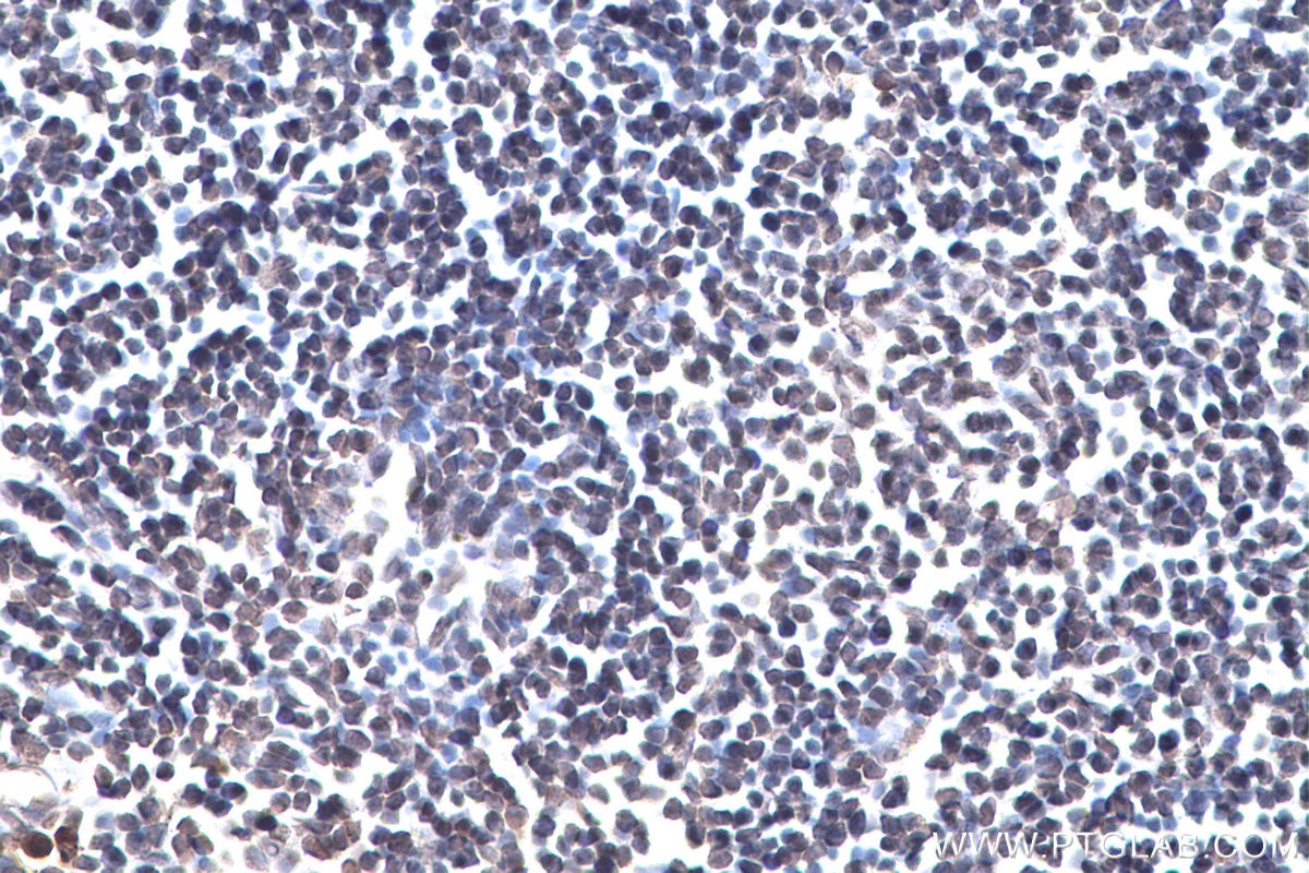 Immunohistochemistry (IHC) staining of rat lymph node tissue using chemical compound m6A Monoclonal antibody (68055-1-Ig)