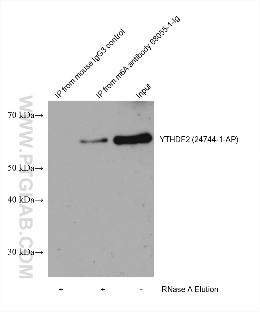 RIP experiment of RNA using chemical compound m6A Monoclonal antibody (68055-1-Ig)