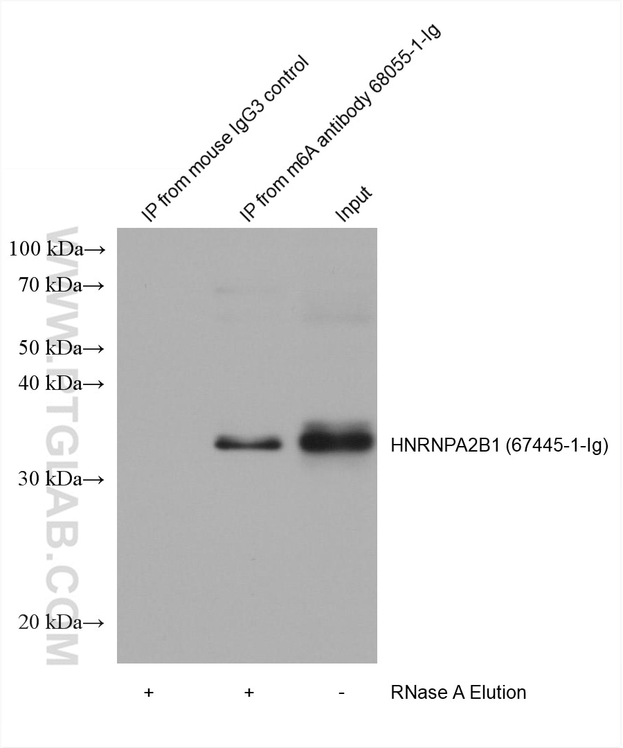 RIP experiment of RNA using m6A Monoclonal antibody (68055-1-Ig)