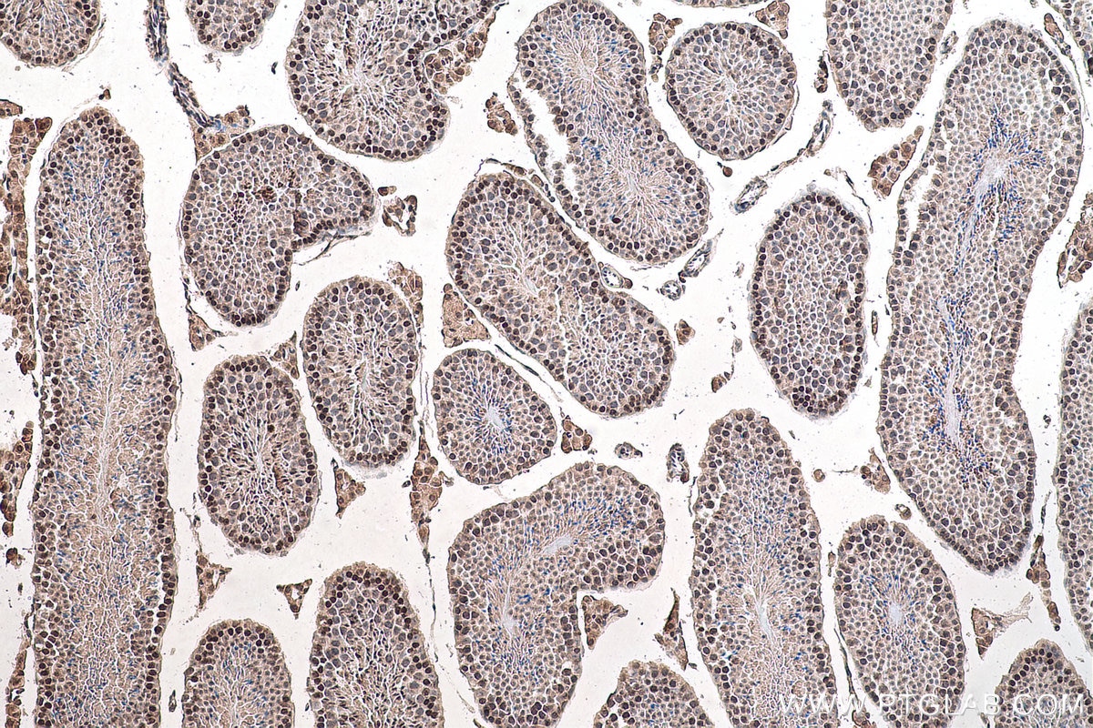 Immunohistochemistry (IHC) staining of mouse testis tissue using m7G Monoclonal antibody (68302-1-Ig)