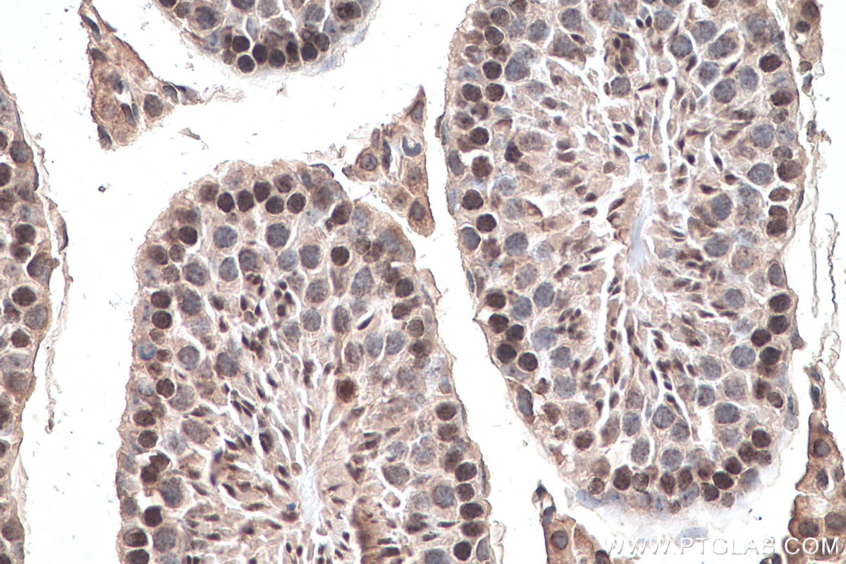 Immunohistochemistry (IHC) staining of mouse testis tissue using m7G Monoclonal antibody (68302-1-Ig)