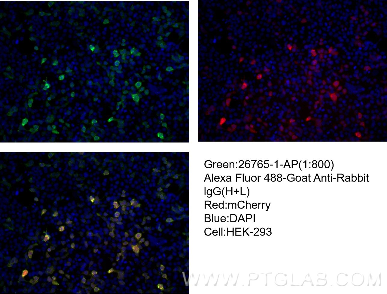 Immunofluorescence (IF) / fluorescent staining of Transfected HEK-293 cells using mCherry Polyclonal antibody (26765-1-AP)