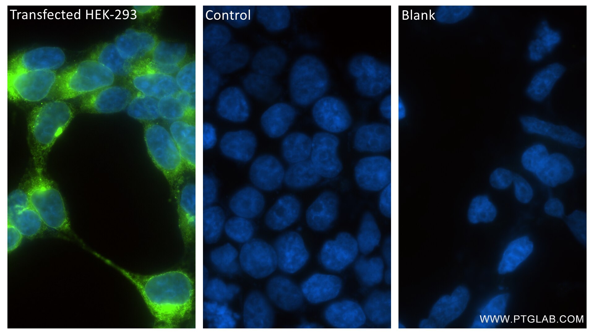 Immunofluorescence (IF) / fluorescent staining of Transfected HEK-293 cells using mCherry Recombinant antibody (81202-2-RR)