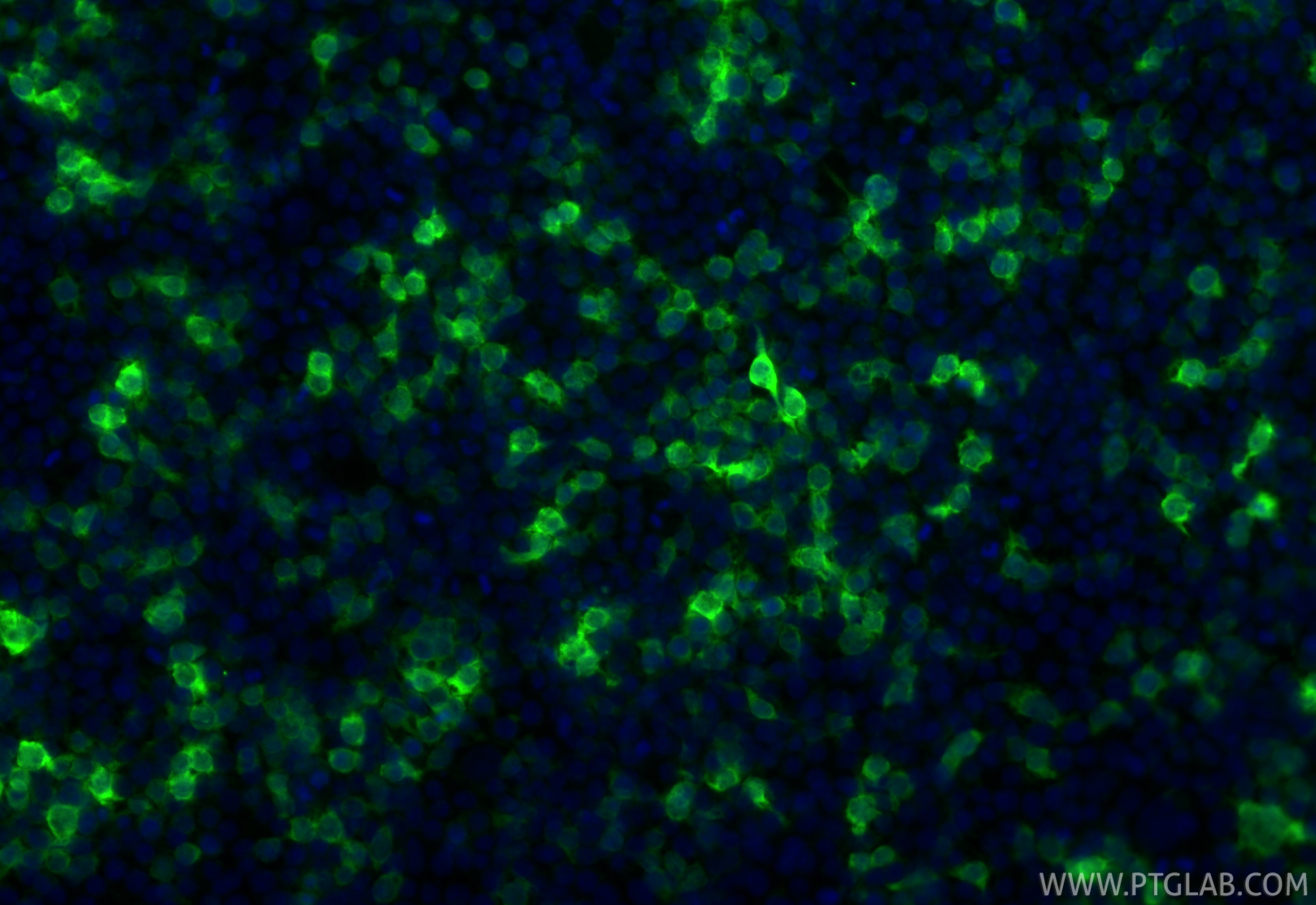Immunofluorescent analysis of (-20°C Ethanol) fixed Transfected HEK-293 cells using CoraLite® Plus 488 mCherry antibody (CL488-81202-2, Clone: 241830F8 ) at dilution of 1:200. Immunofluorescence (IF) / fluorescent staining of Transfected HEK-293 cells using CoraLite® Plus 488-conjugated mCherry Recombinant (CL488-81202-2)