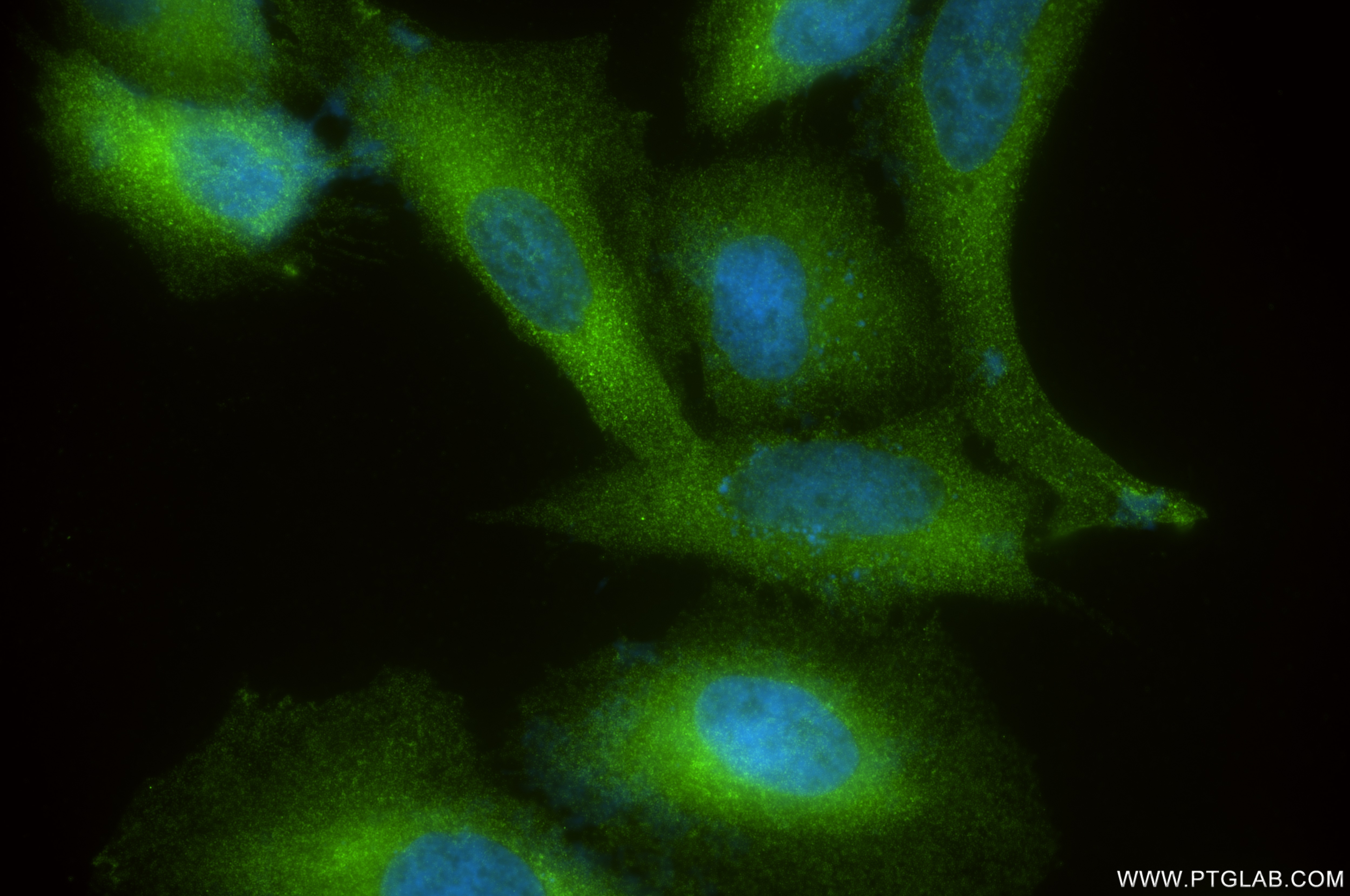 Immunofluorescence (IF) / fluorescent staining of HeLa cells using mDia1 Recombinant antibody (85708-2-RR)