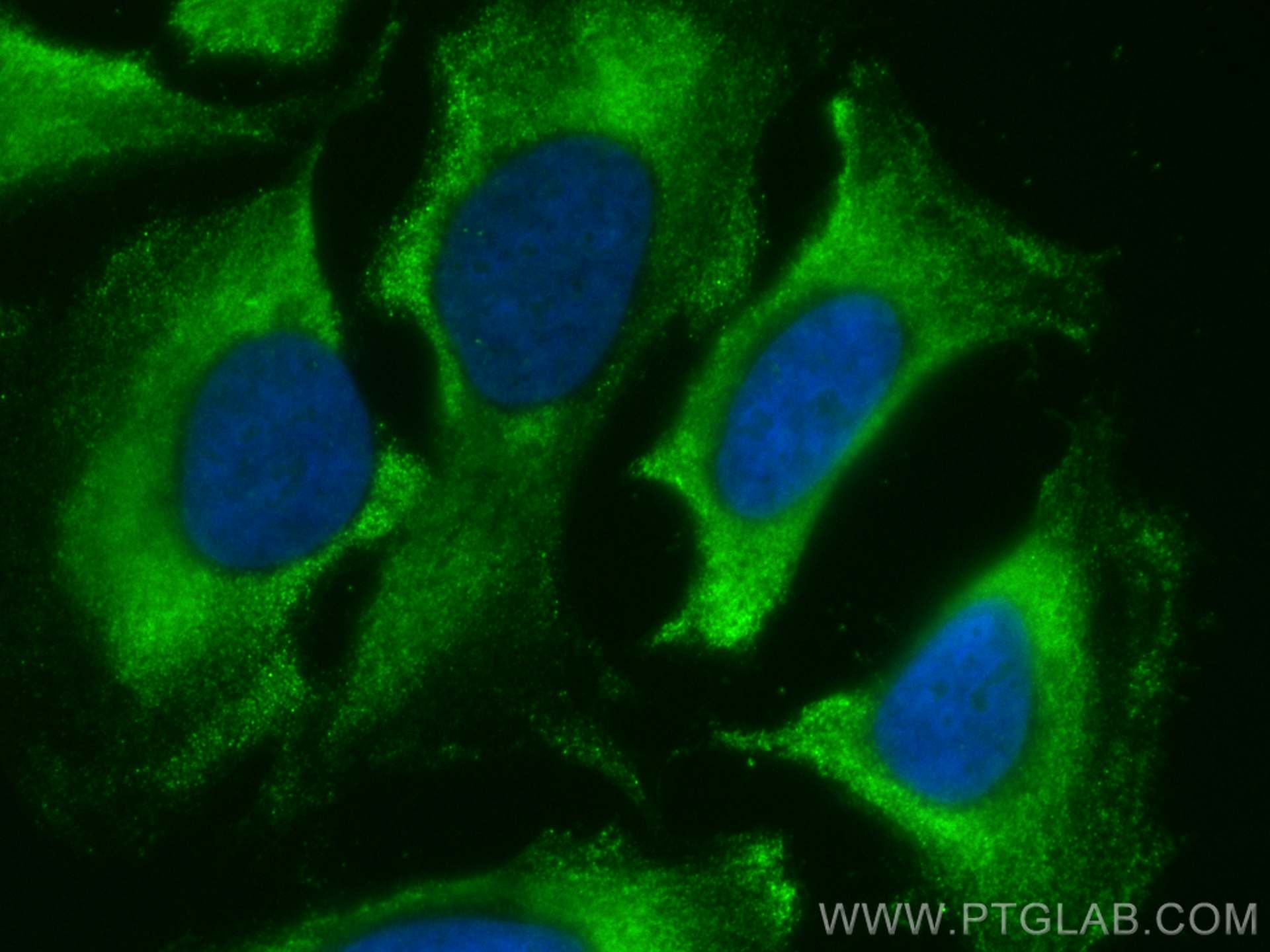 Immunofluorescence (IF) / fluorescent staining of HeLa cells using CoraLite® Plus 488-conjugated mDia1 Polyclonal ant (CL488-20624)